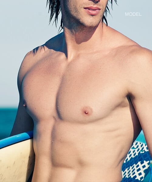Male Breast Reduction in Newport Beach, CA