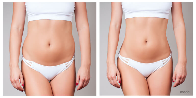 Before and after image of model.