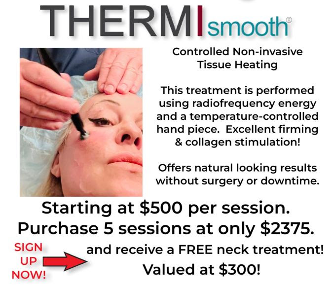 Thermismooth