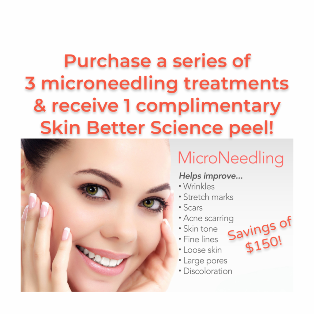 Newport beach microneedling treatment special offer
