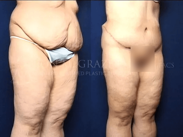 Before and After Image