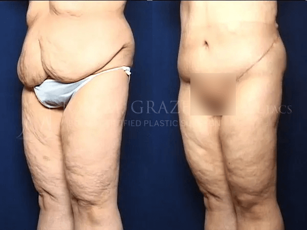 Before and After Image