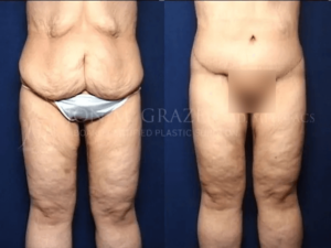 Before and After Image