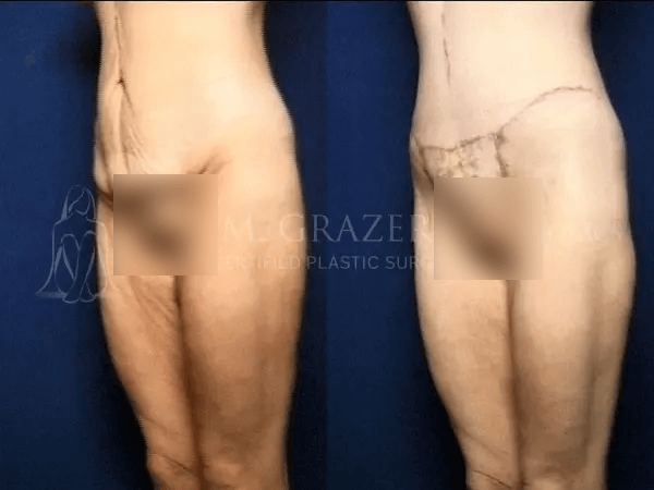 Before and After Image