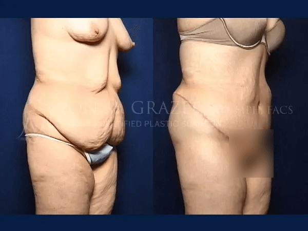 Before and After Image