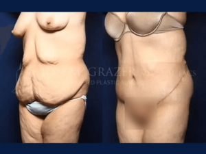 Before and After Image