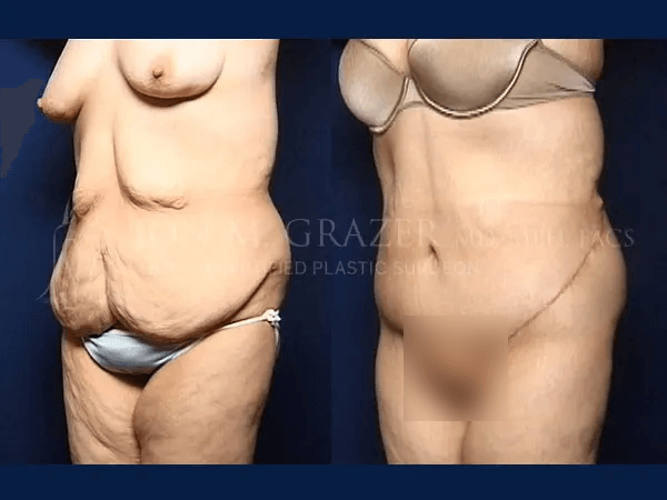 Before and After Image