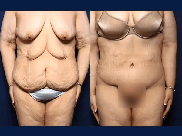 Before and After Image