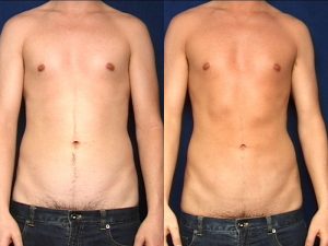 Before and After Image