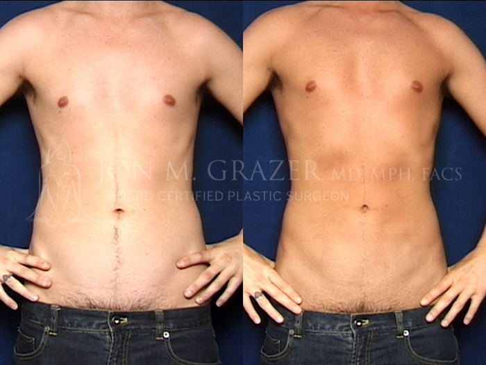 Before and After Image