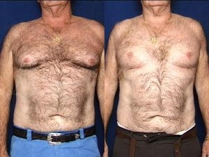 Before and After Image