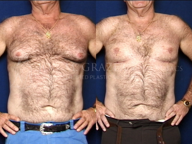 Before and After Image