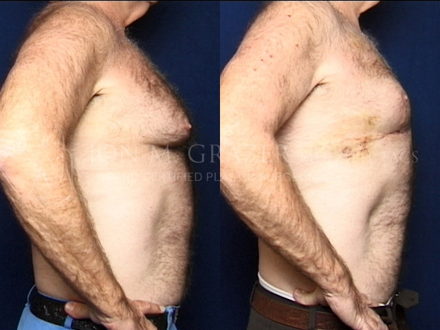 Before and After Image