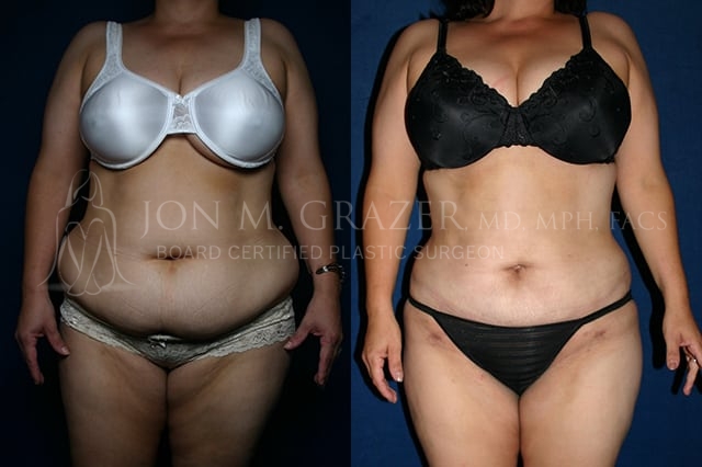 Before and After Image