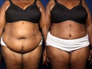 Before and After Image