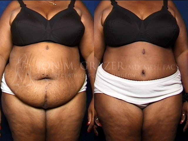 Before and After Image