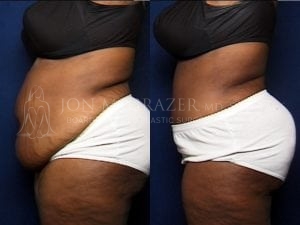 Before and After Image