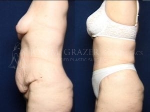 Before and After Image