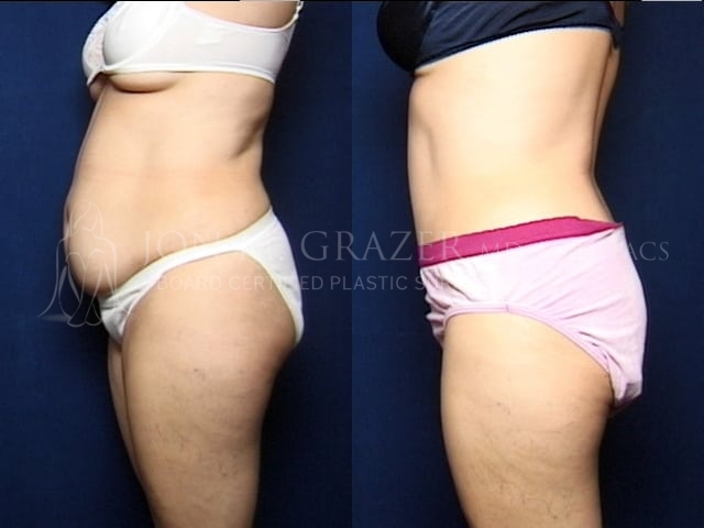 Before and After Image