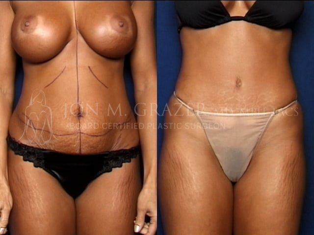 Before and After Image