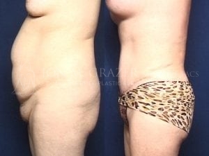 Before and After Image