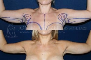 Before and After Image