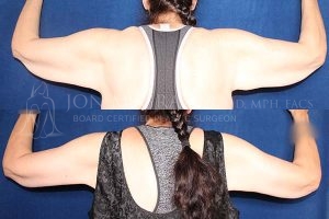 Before and After Image