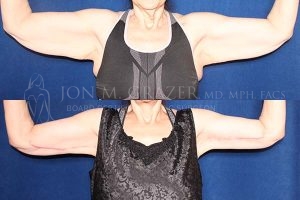 Before and After Image