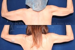 Before and After Image