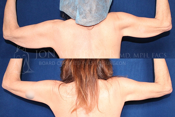 Before and After Image