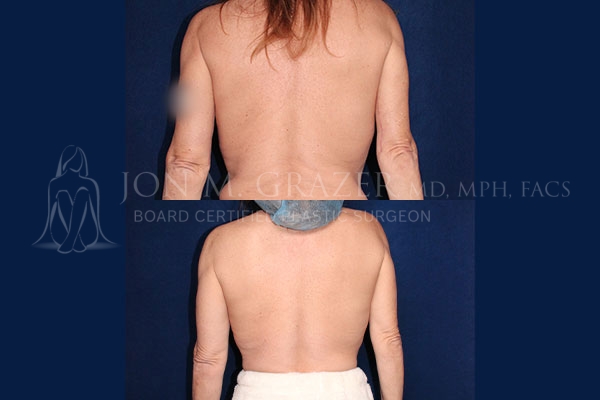 Before and After Image