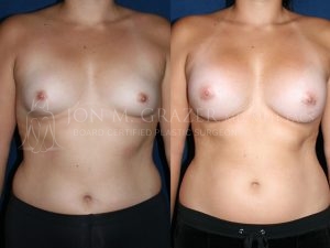 Before and After Image