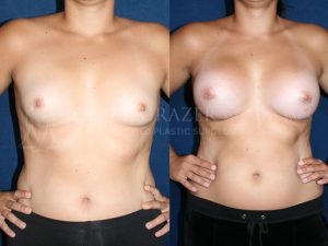 Before and After Image