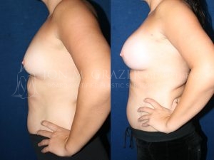 Before and After Image