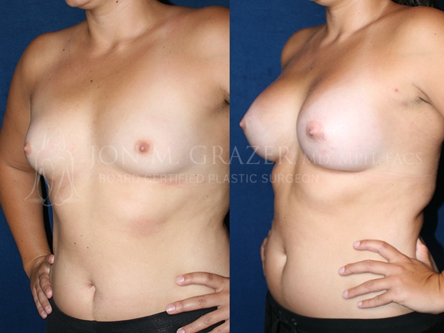 Before and After Image