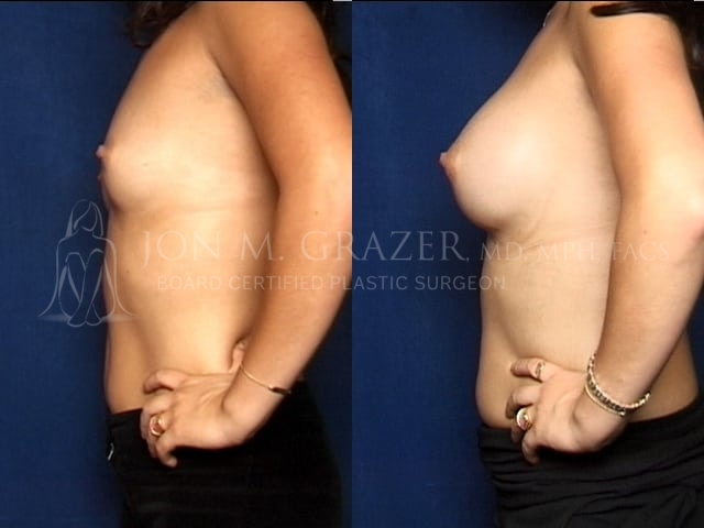 Before and After Image