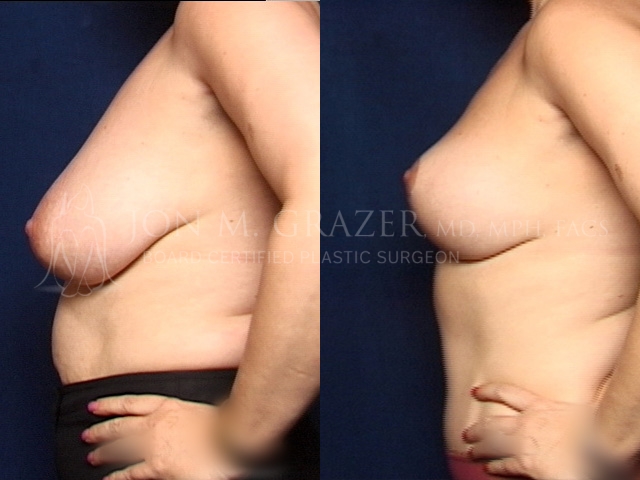 Before and After Image