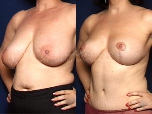 Before and After Image