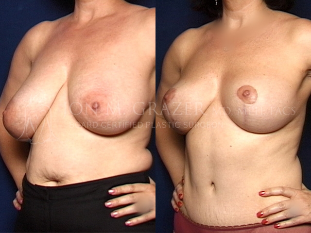 Before and After Image