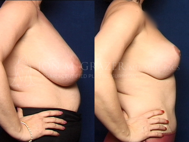 Before and After Image