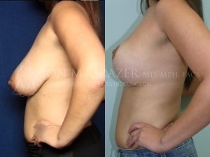 Before and After Image