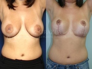 Before and After Image