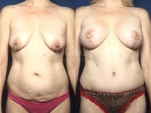 Before and After Image