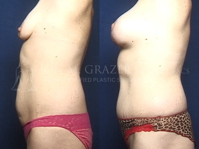 Before and After Image