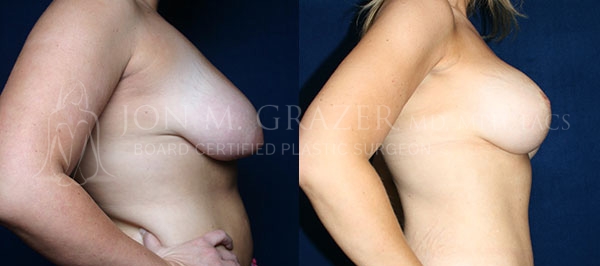 Before and After Image