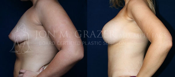 Before and After Image