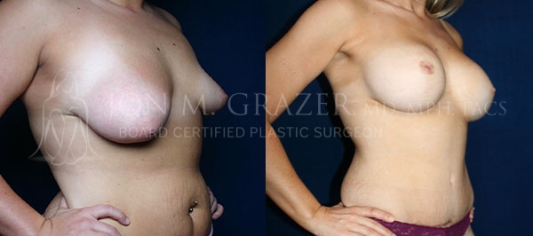 Before and After Image