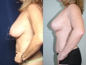 Before and After Image