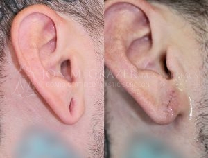 Before and After Image