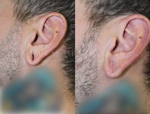 Before and After Image